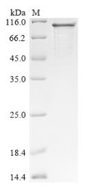 SDS-PAGE (TIPARP-5633H).jpg